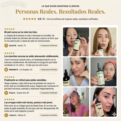 👑 Woodsleep™ Golden Micro-Peptide Serum✨ Suero Facial Avanzado con Micropéptidos Dorados para una Piel Más Firme, Radiante y de Apariencia Renovada