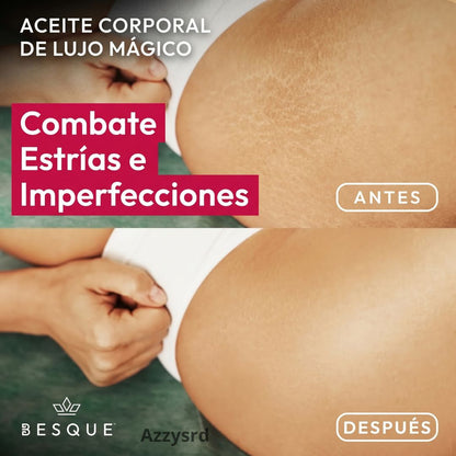 **Besque® Magic Body Oil — Elixir Corporal Reafirmante y Luminoso** ✨ **Hidrata profundamente, suaviza y ayuda a mejorar la apariencia firme y radiante de tu piel.**
