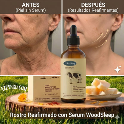 👑 Woodsleep™ Golden Micro-Peptide Serum✨ Suero Facial Avanzado con Micropéptidos Dorados para una Piel Más Firme, Radiante y de Apariencia Renovada
