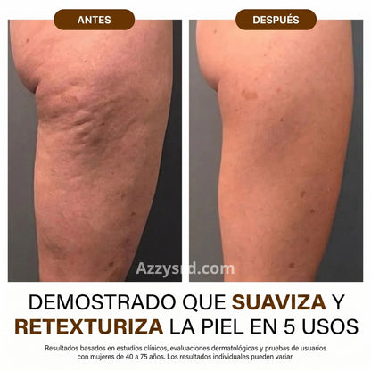 ✨ GODA Aceite Corporal de Seda™ | Reafirma, Ilumina e Hidrata Intensamente la Piel ✨ 🌸 Fórmula Antiedad de Lujo que Ayuda a Mejorar la Elasticidad, Suavizar la Apariencia de la Piel y Dejar un Acabado Sedoso y Radiante.