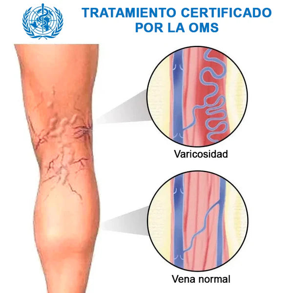 Tu Solución!!! Parches Anti-varices ¡SUPER OFERTA 2x1! 24 Unidades En 2 Paquetes!