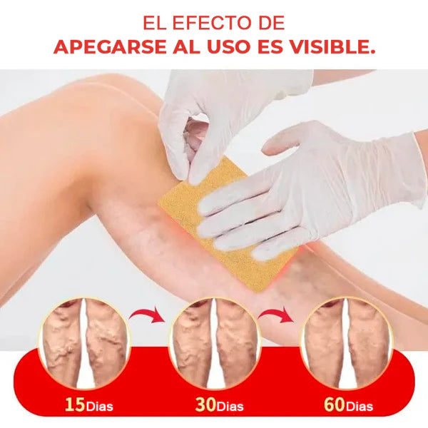 Tu Solución!!! Parches Anti-varices ¡SUPER OFERTA 2x1! 24 Unidades En 2 Paquetes!