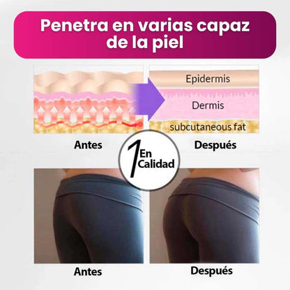 HIP UP™💖🔥 – Levanta, Reafirma y Re-define Tus Glúteos y Silueta 💎 100% Original
